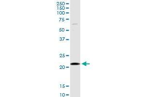 SELS MaxPab rabbit polyclonal antibody. (Selenoprotein S 抗体  (AA 1-187))