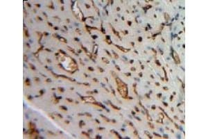 #VALUE! (Angiopoietin 4 抗体  (AA 270-490))