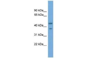 PRPSAP2 antibody used at 0. (PRPSAP2 抗体  (Middle Region))