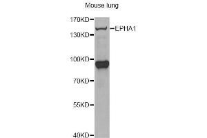 Western blot analysis of extracts of mouse lung, using EPHA1 antibody (ABIN6290349) at 1:1000 dilution. (EPHA1 抗体)