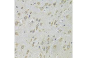 Immunohistochemistry of paraffin-embedded mouse brain using DHRS9 Antibody (ABIN5973740) at dilution of 1/100 (40x lens). (DHRS9 抗体)
