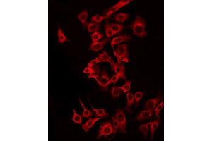 Immunofluorescence (fixed cells) (IF/ICC) image for anti-Solute Carrier Family 24 (Sodium/potassium/calcium Exchanger), Member 6 (SLC24A6) (C-Term) antibody (ABIN6259261)