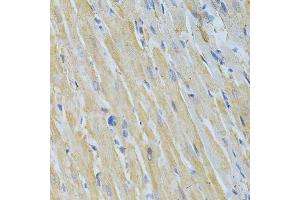 Immunohistochemistry of paraffin-embedded rat heart using NME1 Antibody. (NME1 抗体  (C-Term))