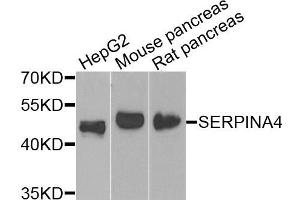 Western blot analysis of extracts of various cells, using SERPINA4 antibody. (SERPINA4 抗体)
