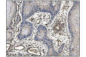 IHC analysis of TAGLN/Transgelin using anti-TAGLN/Transgelin antibody (ABIN7600099). (Transgelin 抗体  (AA 15-170))