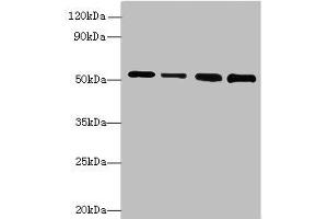 Western blot All lanes: STK38L antibody at 6 μg/mL Lane 1: A375 whole cell lysate Lane 2: HepG2 whole cell lysate Lane 3: A549 whole cell lysate Lane 4: HCT116 whole cell lysate Secondary Goat polyclonal to rabbit IgG at 1/10000 dilution Predicted band size: 55, 44 kDa Observed band size: 55 kDa