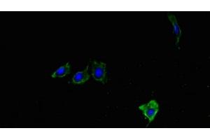 Immunofluorescent analysis of Hela cells using ABIN7176901 at dilution of 1:100 and Alexa Fluor 488-congugated AffiniPure Goat Anti-Rabbit IgG(H+L) (LYPLA1 抗体  (AA 1-230))