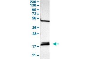 Western Blot analysis of human cell line RT-4 with PTRH2 polyclonal antibody . (PTRH2 抗体  (AA 42-178))