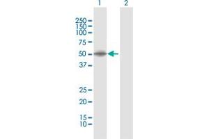 Western Blotting (WB) image for anti-Dihydrolipoamide S-Succinyltransferase (E2 Component of 2-Oxo-Glutarate Complex) (DLST) (AA 1-453) antibody (ABIN947795)