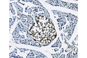 IHC analysis of Transketolase/TKT using anti-Transketolase/TKT antibody (ABIN7598958).