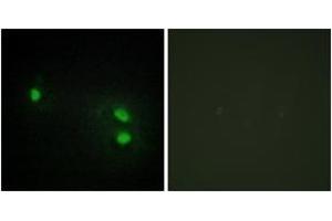 Immunofluorescence analysis of HeLa cells, using Histone H2B Antibody. (Histone H2B 抗体  (AA 1-50))