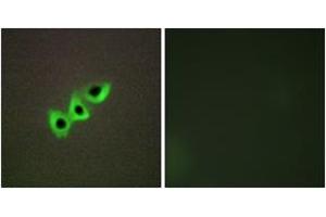 Immunofluorescence analysis of A549 cells, using RHG07 Antibody. (DLC1 抗体  (AA 61-110))