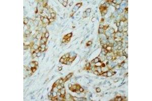 Image no. 1 for anti-V-Akt Murine Thymoma Viral Oncogene Homolog 1/2 (AKT1/2) (N-Term) antibody (ABIN1494209) (AKT1/2 抗体  (N-Term))