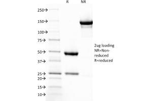 SDS-PAGE Analysis Purified Thrombomodulin Mouse Monoclonal Antibody (THBD/1782). (Thrombomodulin 抗体  (AA 69-194))