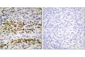 Immunohistochemistry analysis of paraffin-embedded human ovary tissue, using NF-kappaB p105/p50 (Ab-923) Antibody. (NFKB1 抗体  (AA 891-940))