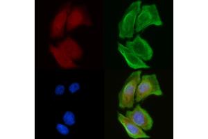 ABIN6257314 and ABIN6274690 staining Hela cells(30 min of UV treatment) by IF/ICC.