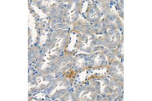 Immunohistochemistry of paraffin embedded rat kidney using Cdcp1 (ABIN7073600) at dilution of 1:300 (400x lens) (CDCP1 抗体)