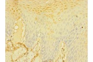 Immunohistochemistry of paraffin-embedded human tonsil tissue using ABIN7147143 at dilution of 1:100 (CD226 抗体  (AA 19-254))