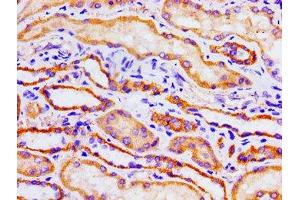 Immunohistochemistry of paraffin-embedded human kidney tissue using ABIN7149308 at dilution of 1:100 (Aconitase 1 抗体  (AA 508-745))