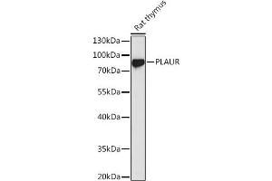 Western blot analysis of extracts of Rat thymus, using PLAUR antibody (ABIN3015469, ABIN3015470, ABIN5663892 and ABIN6218162) at 1:1000 dilution. (PLAUR 抗体  (AA 23-305))
