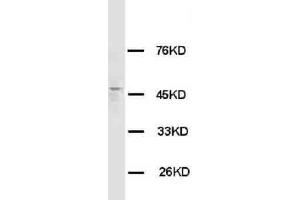 Anti-HRH3 antibody, Western blotting WB: Rat Brain Tissue Lysate (HRH3 抗体  (C-Term))