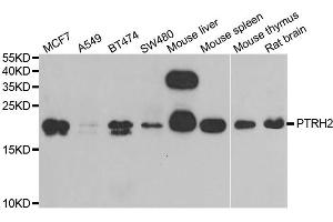 Western blot analysis of extracts of various cell lines, using PTRH2 antibody (ABIN5973864) at 1/1000 dilution. (PTRH2 抗体)