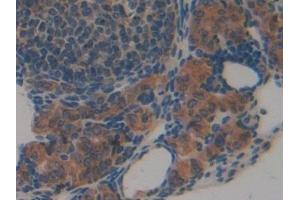 Immunohistochemistry (IHC) image for anti-Calnexin (CANX) (AA 263-482) antibody (ABIN7440107)