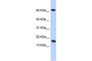 WB Suggested Anti-C4orf46 Antibody Titration: 0. (C4orf46 抗体  (Middle Region))