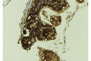 ABIN6276559 at 1/100 staining Mouse colon tissue by IHC-P. (LSD1 抗体  (Internal Region))