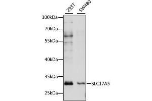 Western blot analysis of extracts of various cell lines, using SLC17A5 antibody (ABIN6294218) at 1:1000 dilution. (Solute Carrier Family 17 (Acidic Sugar Transporter), Member 5 (SLC17A5) 抗体)