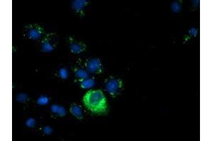 Anti-AFP mouse monoclonal antibody (ABIN2452712) immunofluorescent staining of COS7 cells transiently transfected by pCMV6-ENTRY AFP (RC206622). (alpha Fetoprotein 抗体)