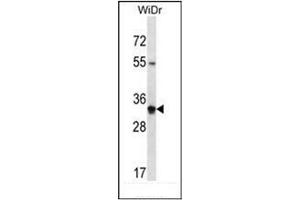 Western blot analysis of OR2W5 Antibody (C-term) in WiDr cell line lysates (35ug/lane). (OR2W5 抗体  (C-Term))