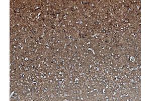 anti-Protein Phosphatase 2, Catalytic Subunit, alpha Isozyme (PPP2CA) (AA 1-309) antibody