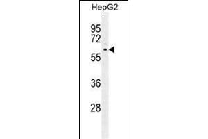 ARD Antibody (C-term) (ABIN655880 and ABIN2845281) western blot analysis in HepG2 cell line lysates (35 μg/lane). (PPARD 抗体  (C-Term))
