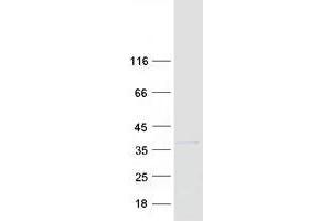 Western Blotting (WB) image for Dual Specificity Phosphatase 12 (DUSP12) protein (Myc-DYKDDDDK Tag) (ABIN2719827)