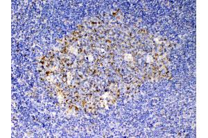 Immunohistochemistry (IHC) image for anti-KIT Ligand (KITLG) (AA 26-190) antibody (ABIN5519022)