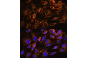 Immunofluorescence analysis of C6 cells using  Rabbit pAb (ABIN6133587, ABIN6137053, ABIN6137054 and ABIN6224632) at dilution of 1:100. (Aquaporin 8 抗体  (AA 50-150))