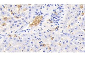 Detection of HBb in Bovine Liver Tissue using Polyclonal Antibody to Hemoglobin Beta (HBb) (Hemoglobin Subunit beta 抗体  (AA 1-145))