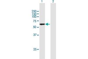 Western Blot analysis of CCDC6 expression in transfected 293T cell line by CCDC6 MaxPab polyclonal antibody. (CCDC6 抗体  (AA 1-474))