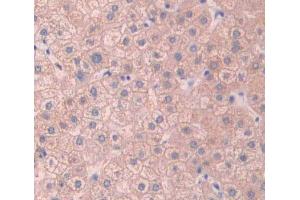 Used in DAB staining on fromalin fixed paraffin- embedded Kidney tissue (ABCB11 抗体  (AA 421-663))