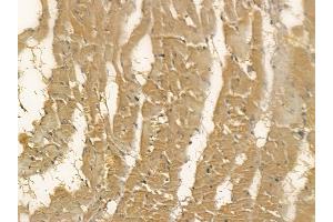 DCXR Mouse Monoclonal Antibody at 1/100 staining rat heart tissue by IHC-P. (DCXR 抗体)