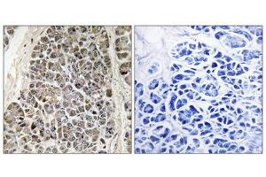 Immunohistochemistry analysis of paraffin-embedded human pancreas tissue using MRPS21 antibody. (MRPS21 抗体  (Internal Region))
