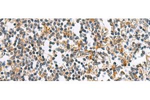 Immunohistochemistry of paraffin-embedded Human tonsil tissue using GUCA1A Polyclonal Antibody at dilution of 1:105(x200) (GCAP1 抗体)
