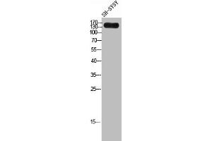 Western Blot analysis of SH-SY5Y cells using Laminin γ-3 Polyclonal Antibody (LAMC3 抗体  (C-Term))