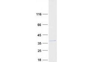 Western Blotting (WB) image for Chromosome 11 Open Reading Frame 46 (C11orf46) protein (Myc-DYKDDDDK Tag) (ABIN2715380)