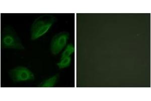 Immunofluorescence analysis of HeLa cells, using Lck (Ab-505) Antibody. (LCK 抗体  (AA 460-509))