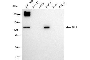 Western blotting analysis using RB1 antibody (ABIN7800184).