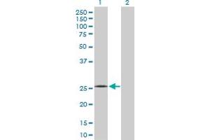 Western Blotting (WB) image for anti-Complement Component 1, Q Subcomponent, B Chain (C1QB) (AA 1-253) antibody (ABIN513854)
