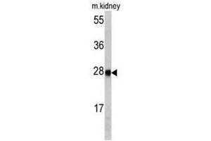 Image no. 1 for anti-Ethylmalonic Encephalopathy 1 (ETHE1) (Middle Region) antibody (ABIN452981) (ETHE1 抗体  (Middle Region))