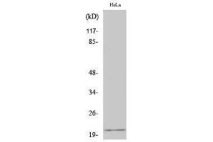 Western Blotting (WB) image for anti-EP300 Interacting Inhibitor of Differentiation 1 (EID1) (Internal Region) antibody (ABIN3184436) (EID1 抗体  (Internal Region))